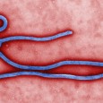 Ebola, previously known as Ebola hemorrhagic fever, is a rare and deadly disease caused by infection with one of the Ebola virus strains. 